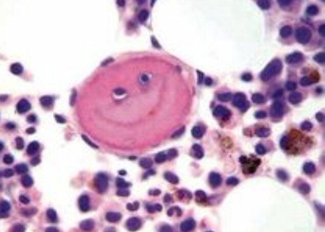 Quique_rs's tweet photo. @DraEosina @RikiSotillo thank you so much for the welcome! I'll try upload more cases #GIPath https://t.co/GB4Lf5U66U