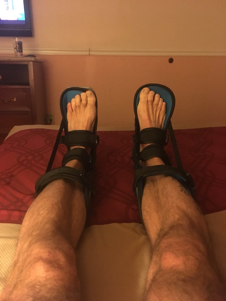 Walkabout_Slang's tweet photo. Legs shackled for cramp mitigation. Yay.
And to think I’ve signed up for two more. #stupid #GTFOD https://t.co/8sOAqwxaWM
