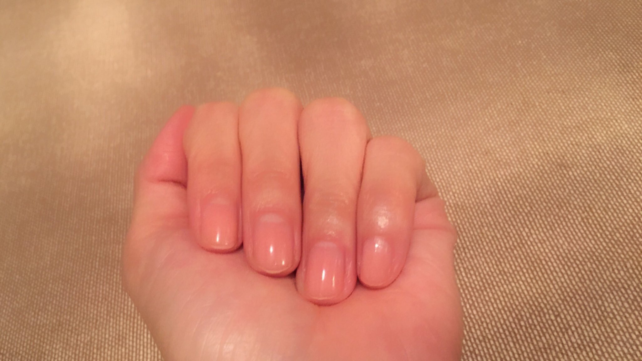 なおみん 健康と美容の中医学 爪の色で体の状態をみる 白っぽい 血液不足 紫っぽい 血液の滞り 冷え 赤っぽい 熱がこもっている 黄色っぽい 余分な水分がたまっている 灰色っぽい なおみん 健康と美容の中医学 爪の色で体の状態をみる 白っぽい 血液不足 紫っぽい 血液の滞り 冷え 赤っぽい 熱がこもっている 黄色っぽい 余分な水分がたまっている 灰色っぽい