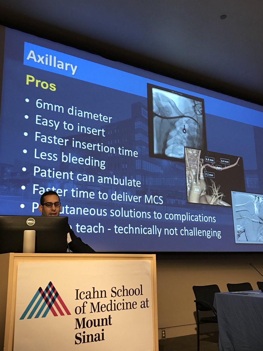 chadialraies's tweet image. Advantage of  #PercAx for large bore sheath - @DrAmirKaki #ACCIC #ACCFIT #ACC18 #SCAI2018