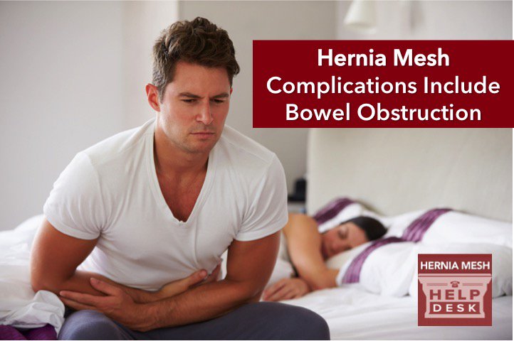 HerniaMeshHelp's tweet image. Is hernia mesh causing your #pain? Learn the complications associated with #herniamesh impactlaw.com/defective-medi…