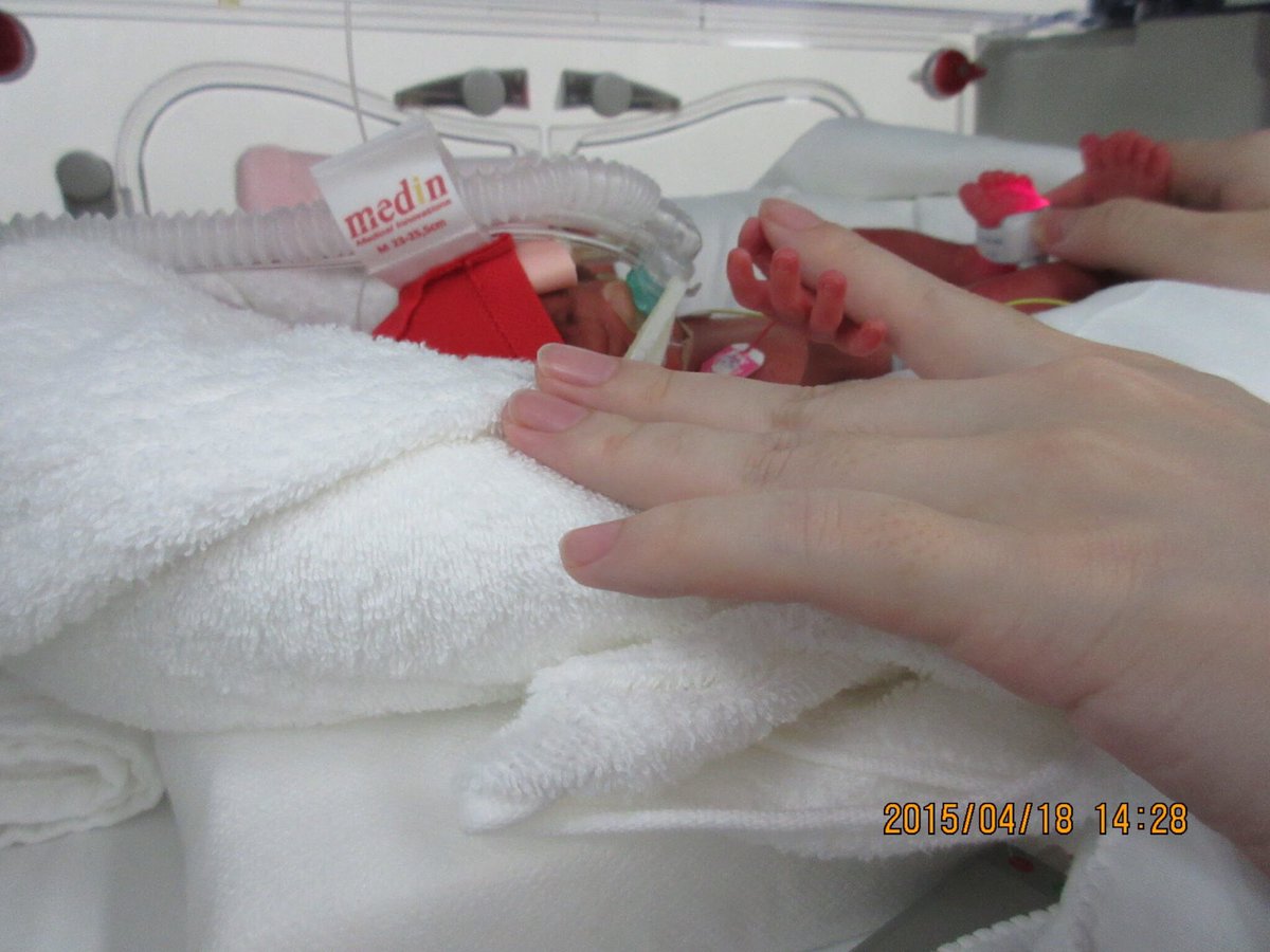 コルメキッサ 残り2日 1 22 日 までオープン 未だに驚かれますが 私の娘は19週から切迫流産 となり私は寝たきり入院 2ヶ月半闘病しましたが 28週で2ヶ月半も早く産まれました 38 1298gから 現在2歳10ヶ月 91 13キロになりました 障害も