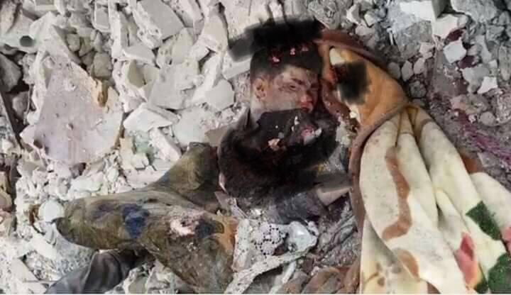 Edress Othman, MD tweet media