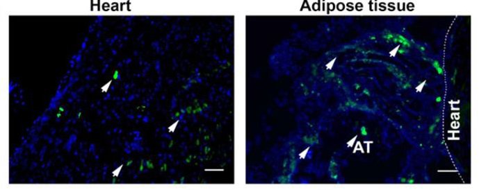 The pericardial adipose tissue contains lymphoid clusters  in which B cells, dendritic cells and T cells expand in response to #MI goo.gl/tsdApm