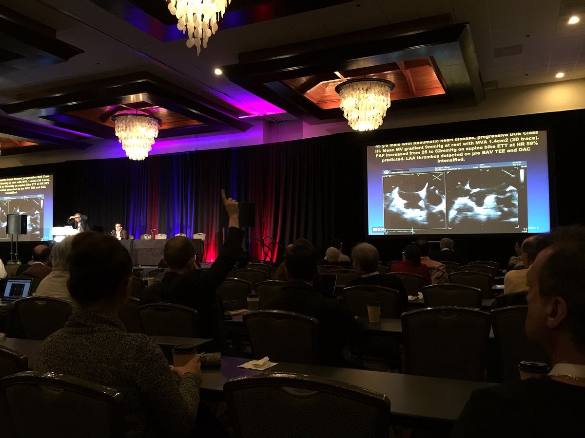 echogenics's tweet photo. @ASE360 day 3 of #EchoSOTA in beautiful SD! Looking forward to a full day of great talks and cases! #ASE #ASE360 #ASE2018 #Echogenics #SanDiego https://t.co/y14dIGKAef