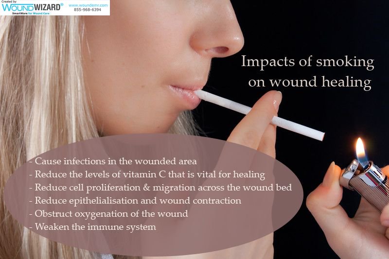 woundwizardemr's tweet photo. Smoking can negatively affect your wound healing process: https://t.co/vksak4Oha7 https://t.co/EFd7ZfC7bL