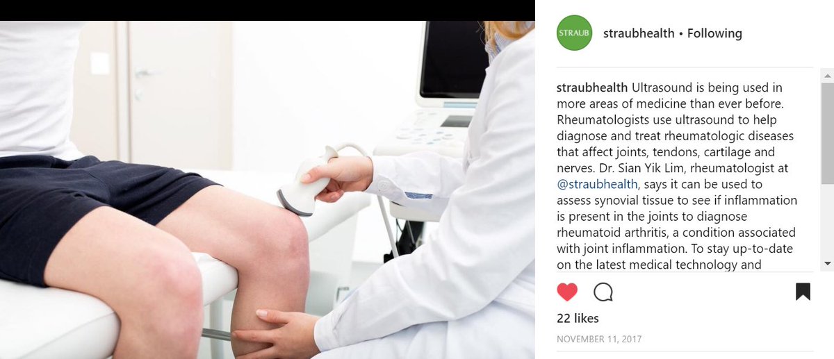 Photo by @straubhealth - Dr. Sian Yik Lim, rheumatologist at @straubhealth, says it can be used to assess synovial tissue to see if inflammation is present in the joints to diagnose rheumatoid arthritis
deepsta.com/media/16462399…