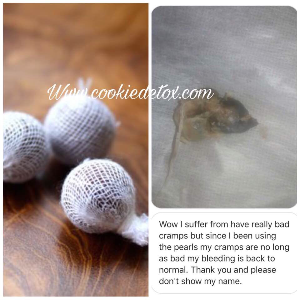 prissy_chickk's tweet image. 😿kitty not right ? Follow @cookiedetox @yonidetox @yonipearls $18.99 SHIPPED 📦If ordered by Tonight! By @kaybellanova #yonidetox #cookiedetpx #cleanse #steam #blacchyna