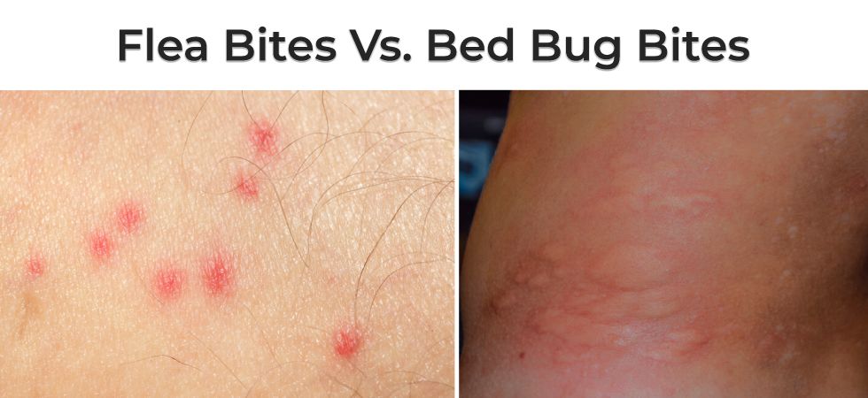 Flea Bites Treatment Natural Remedies Flea Bites Treatment Natural Remedies