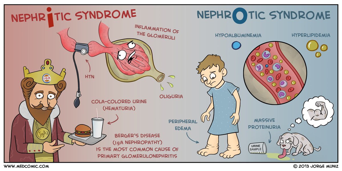 ãnephrotic vs nephritic mnemonicãçåçæå°çµæ