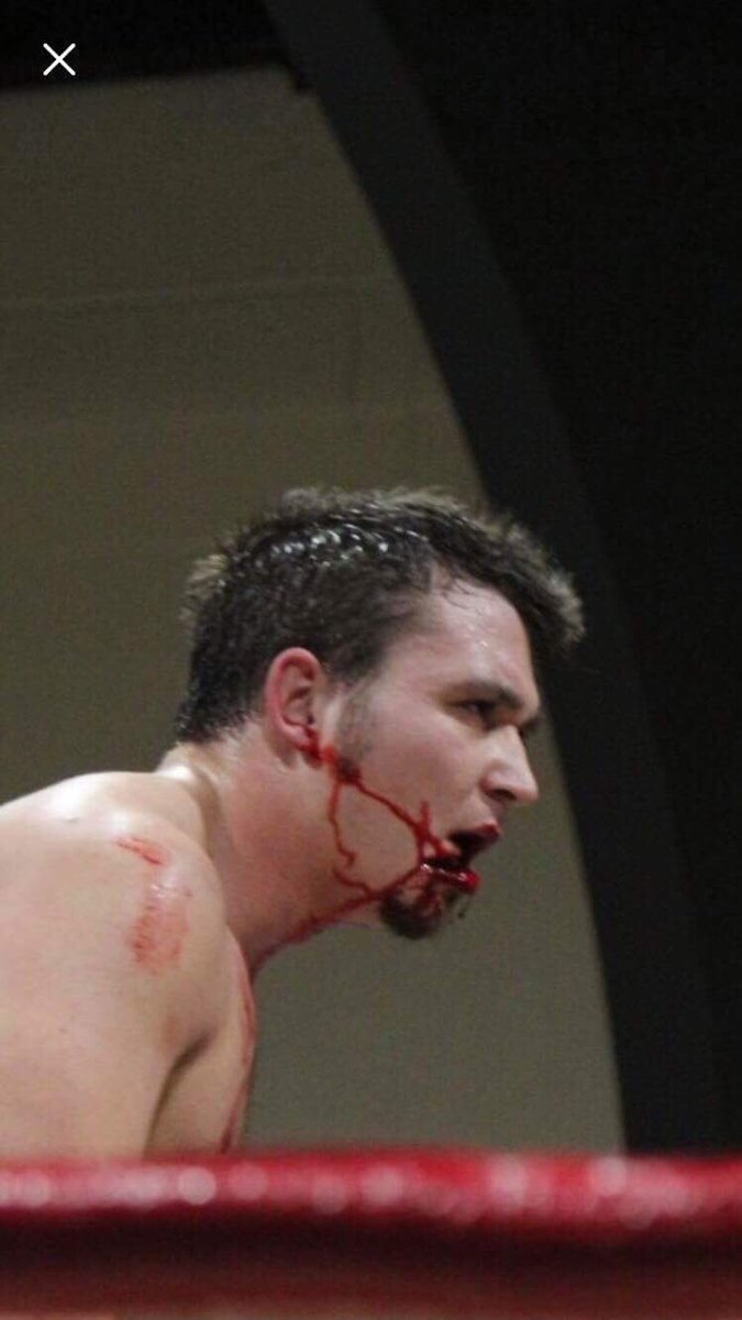 JPWARHORSE's tweet image. I had a Turnbuckle ripped out of my face during a Wrestling Match and Finished the Match.
#AndThatsHowIGotThisScar