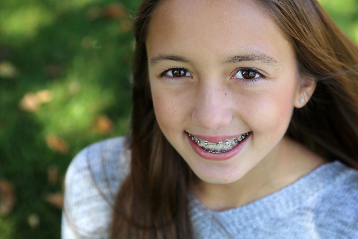 ChantillySmiles's tweet image. What Is An Underbite?
ow.ly/VhC850gfL6K

An underbite is a misalignment where your lower teeth are either too far forward or upper teeth are too far back. Dr. Urquiaga can help you straighten your smile.
 
#Underbite #TeethMisalignment #RealignTeeth