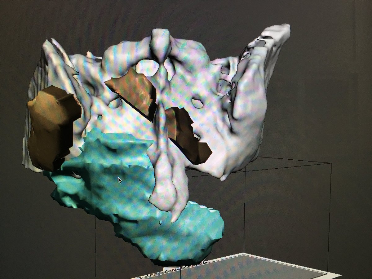 rupermac's tweet photo. Post-process of radiological study to generate the #biomodel of this #sarcoma of the sacrum, and the patient-specific guides necessary for tumor resection. So we shorten the surgery in half and we are more precise! #medical3dprinting @3d_maranon #HospitalGregorioMarañon @3dheals https://t.co/BBO3ujHRLD