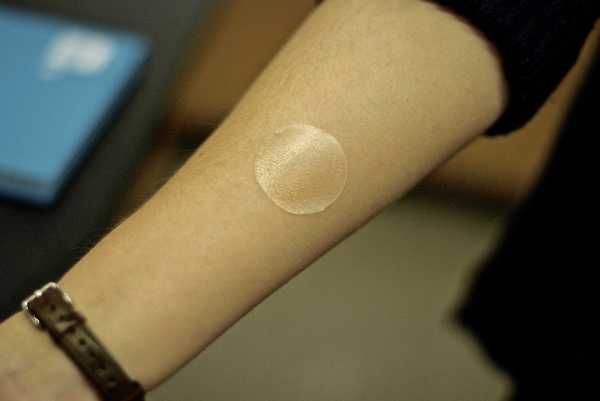 Velocity (@uwvelocity) on Twitter photo .<a href="/AvroSci/">Avro Life Science</a> aims to deliver drugs to children and the elderly through skin patches. Read more here: ow.ly/LVqR30iw9bn .<a href="/AvroSci/">Avro Life Science</a> aims to deliver drugs to children and the elderly through skin patches. Read more here: ow.ly/LVqR30iw9bn