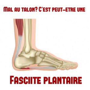 Douleur au talon? Pire les premiers pas le matin et en fin de journée? Sensation de brûlure ou d’aiguille? Difficulté à mettre le talon par terre? Difficile de repartir une fois au repos? Laissez-nous vous aider! Prenez rendez-vous! #fasciiteplantaire