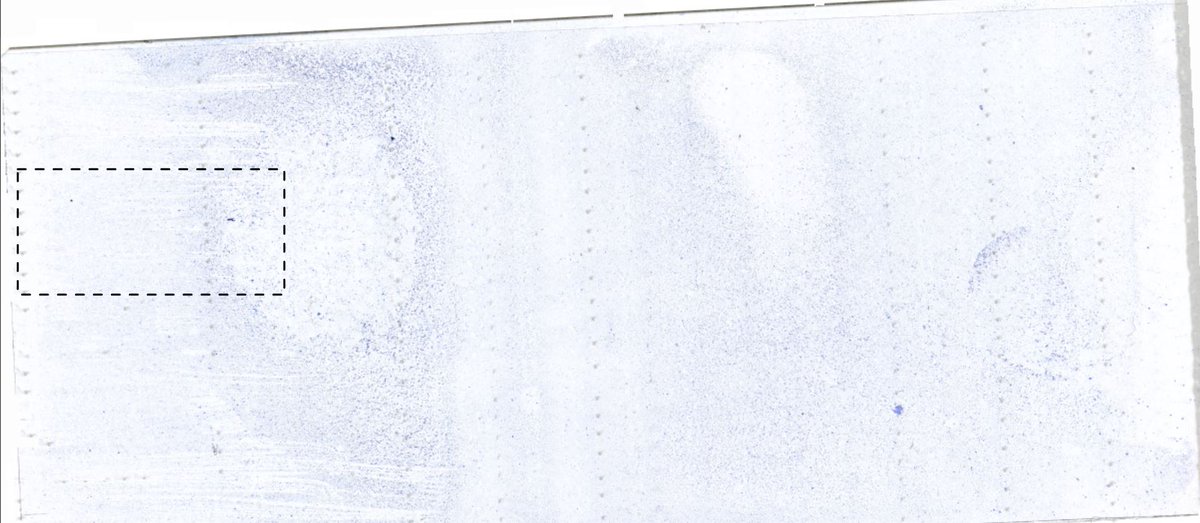 Lacunadiag's tweet image. This 7 month old German Shepherd #dog presented for #pleural #effusion causing difficulty breathing. What&apos;s going on here? The time to diagnosis in this case was 32 minutes! Another great example of @Lacunadiag helping treatment start faster in an emergency! #TreatWithConfidence