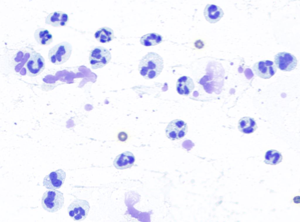 Lacunadiag's tweet image. This 7 month old German Shepherd #dog presented for #pleural #effusion causing difficulty breathing. What&apos;s going on here? The time to diagnosis in this case was 32 minutes! Another great example of @Lacunadiag helping treatment start faster in an emergency! #TreatWithConfidence