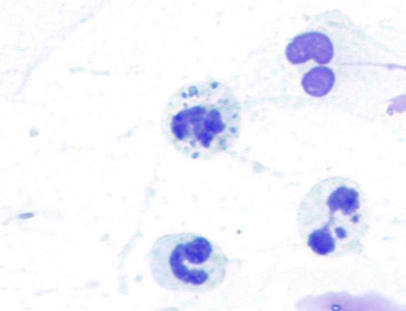 Lacunadiag's tweet image. This 7 month old German Shepherd #dog presented for #pleural #effusion causing difficulty breathing. What&apos;s going on here? The time to diagnosis in this case was 32 minutes! Another great example of @Lacunadiag helping treatment start faster in an emergency! #TreatWithConfidence