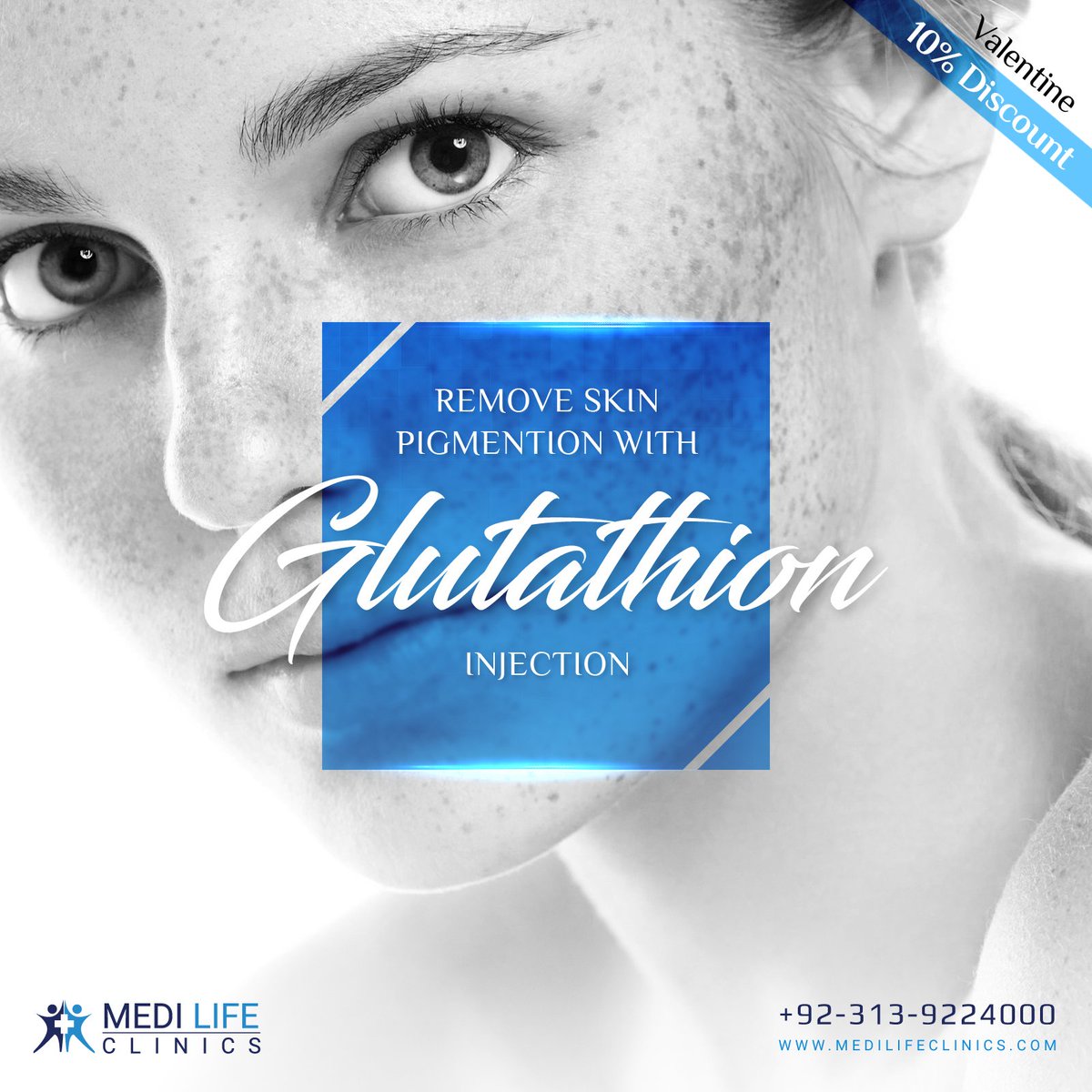 MediLifekhi's tweet photo. We pay greater attention to diagnose the fundamental cause of the pigmentation problem. We have so far treated hundreds of people with pigmentation problem.

#Medilife #MedilifeClinics #Glutathion #Pigmentation #GlutathionInjection #FaceTreatment #SkinTreatment #PSL https://t.co/0BInJbIHHd