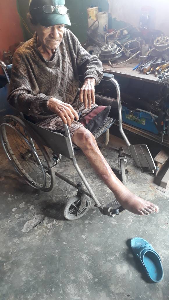 ElNacionalWeb's tweet image. #ServicioPúblico Para señor en grave estado de pobreza. Diabético con ACV y discapacidad en la pierna. Omeprazol, Meformina, glibenciamida, INSULINA MPH. 04164294002