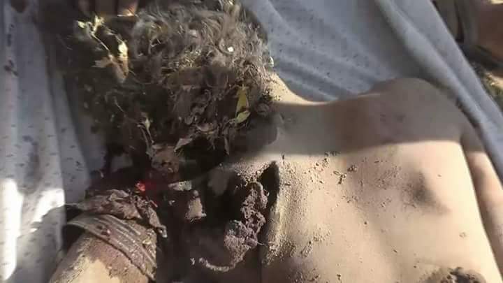 ghalebalsudmy's tweet photo. Now when I see suffers Yemeni people, 
 I know that the slogans of humanity are cheaper than the price of ink used in writing it.
#Yemen https://t.co/iN1gNfJp12