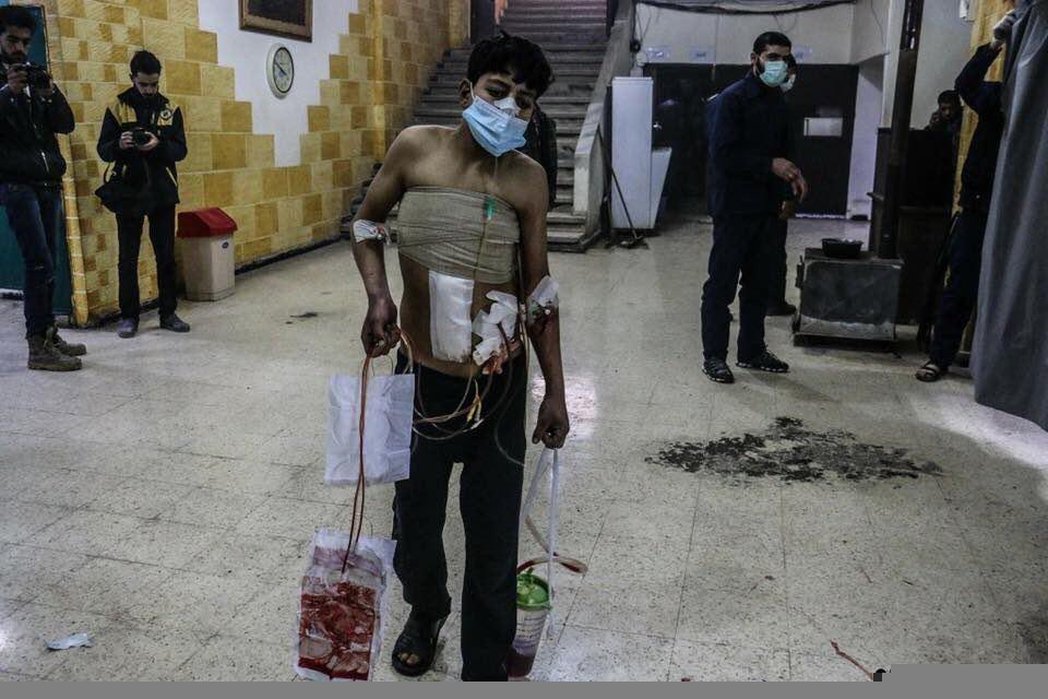 جمهوری اسلامی سال‌هاست که دستش تنها به خون مردم داخل ایران آغشته نیست بلکه در جنایت‌های فراوانی در خارج از مرزهای ایران نیز نقش آفرین بوده است. 

نمونه آخرش همین تصویر از یک نوجوان مجروح سوری در #غوطه_شرقی؛. به درستی که با نگاه کردن به این عکس می‌توان بارها مُرد...