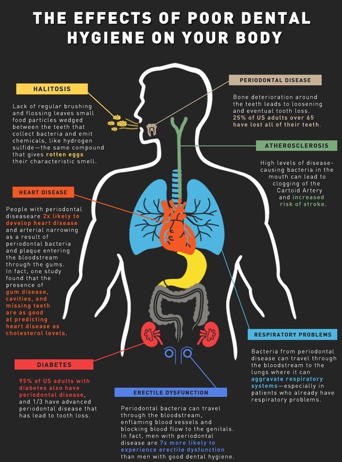 DrTettey's tweet photo. @DeltaDentalNC This is very true. Poor oral health can impact the body in various ways. #HealthyHeartTalk https://t.co/4FGqNhbbQM