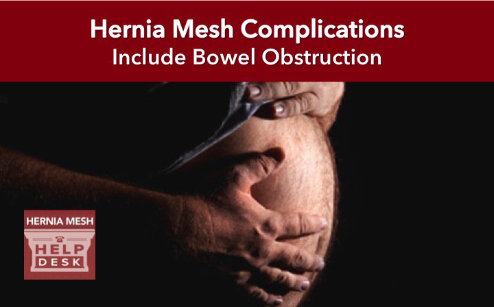 HerniaMeshHelp's tweet image. Is hernia mesh causing your #pain? Learn the complications associated with #herniamesh impactlaw.com/defective-medi…