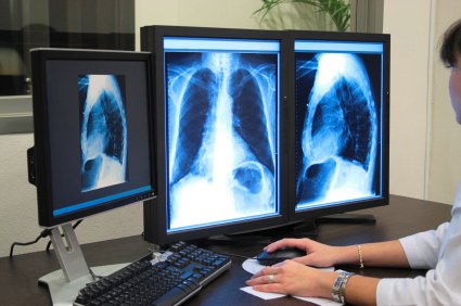 NEXUS_MARABU's tweet photo. Wer druckt denn heute noch Fotos aus? Digitales Bildmanagement im  Krankhaus ist jetzt Voraussetzung für EMRAM Stufe 1. https://t.co/WY0vAmrzhq #Digitalisierung  #EMRAM #HIMSSAnalytics #Gesundheitswesen #healthcare #ehealth https://t.co/RruydIoWto