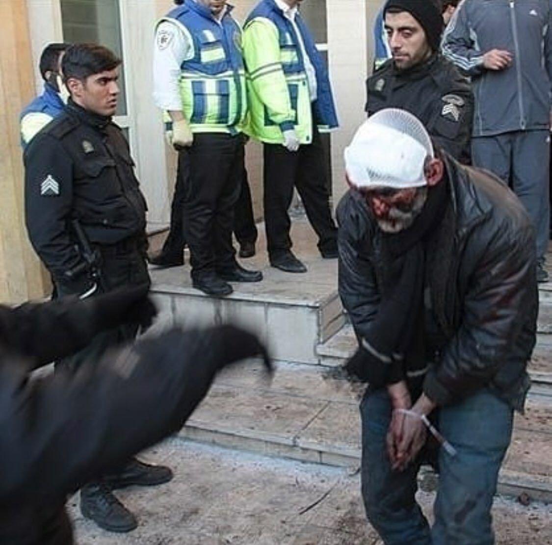 IRANI_Anonymous's tweet photo. Just a small sample of Islamic Republic's treatment of its political detainees!
#Iran #IranProtest #Anonymous https://t.co/3fGgo8LjAg