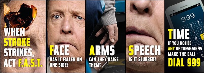 Do you know the signs of stroke? You only need to see ONE sign – Face, Arms, Speech – of the #ActFAST test to call 999.