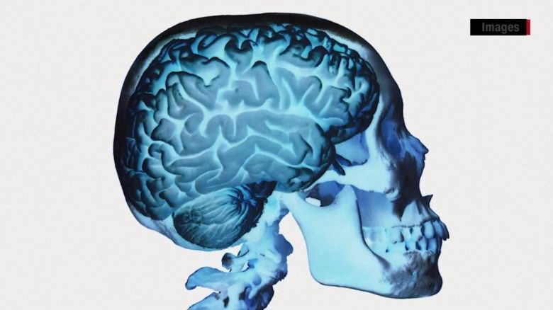 thebraindiva's tweet photo. FDA approves first blood test for concussion https://t.co/1rmnpTzCar https://t.co/g8xnhaiMEa