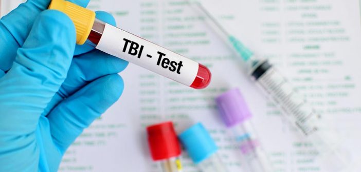 HealthSystemMgm's tweet photo. This test can help physicians determine if further testing is needed https://t.co/1OBSCwLVM0 https://t.co/rE5ULRL42Q