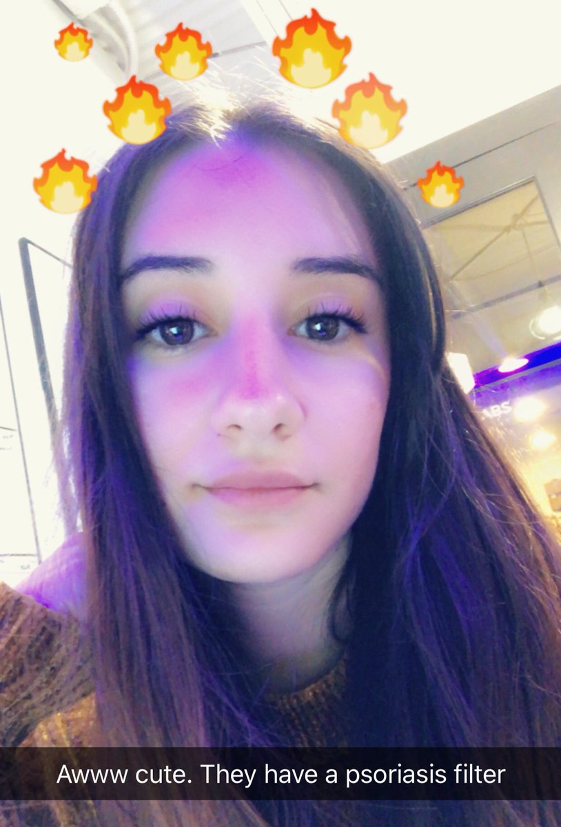 ho11ybaby's tweet photo. RT if you can relate #psoriasis https://t.co/rxM16hGhhL