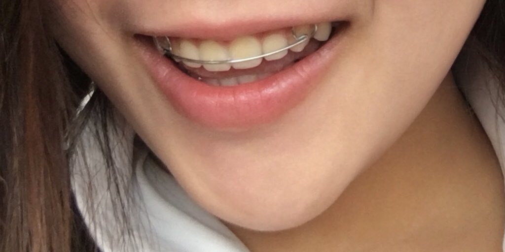 thantylery's tweet image. เป็นชะนีติดลิป รีวิวลิปมันแบบไม่มีสีดีกว่า(แอบทิ้งไปเยอะอยู่) ผู้ชนะคือสองตัวนี้ มันดีจิง โบกไปเยอะๆเลย ไม่ต้องกลัวเปลืองตัง กลัวไม่สวยดีกว่า😂 ใช้แล้วปากไม่คล้ำ ชมพูขึ้นด้วย ราคาน่ารัก รูปปากนั่นคือทาแค่ลิปมันไม่มีสีนะ ไม่ได้ทาอะไรเพิ่มเลย #howtoperfect #ไว้รีวิวห้ามขายของโว้ยย