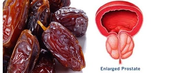 NagarjunaAC's tweet image. Enlarged Prostate – The Ayurveda Approach #malereproductivesystem drcmanojkumar.com/enlarged-prost…