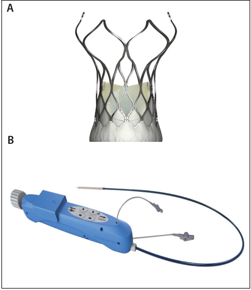 CRT_meeting's tweet photo. The #Centera #transcatheter #selfexpanding #NitinolValve may take #TAVR to the next level for #ParavalvularLeak (#PVL) and permanent #pacemaker #implantation rates, according to the pivotal #safety #study.

Read more: https://t.co/nvE2kkeNxw https://t.co/seE5599R8a