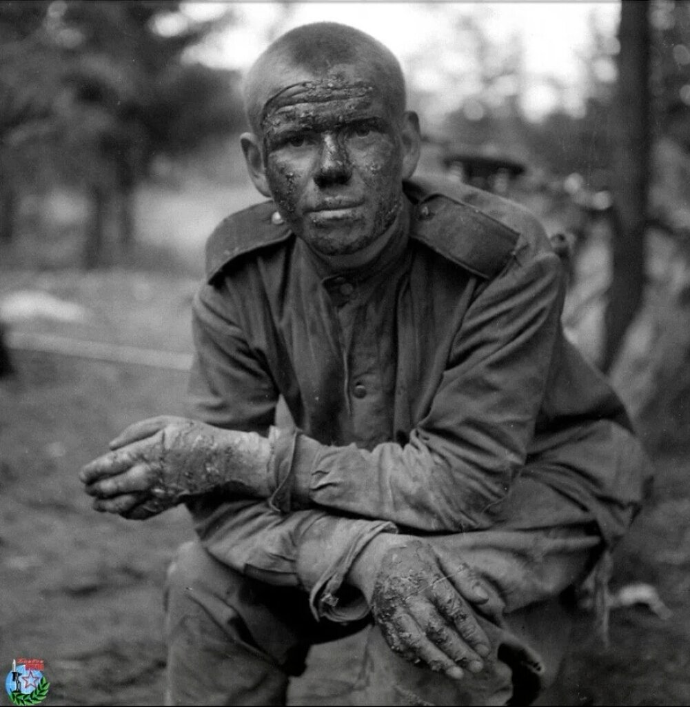Советский солдат горевший в танке, лицо и руки обожжены...
Взгляните ему в лицо...лицо человека который спас свою Родину.
Слава Советскому... солдату Освободителю !!!