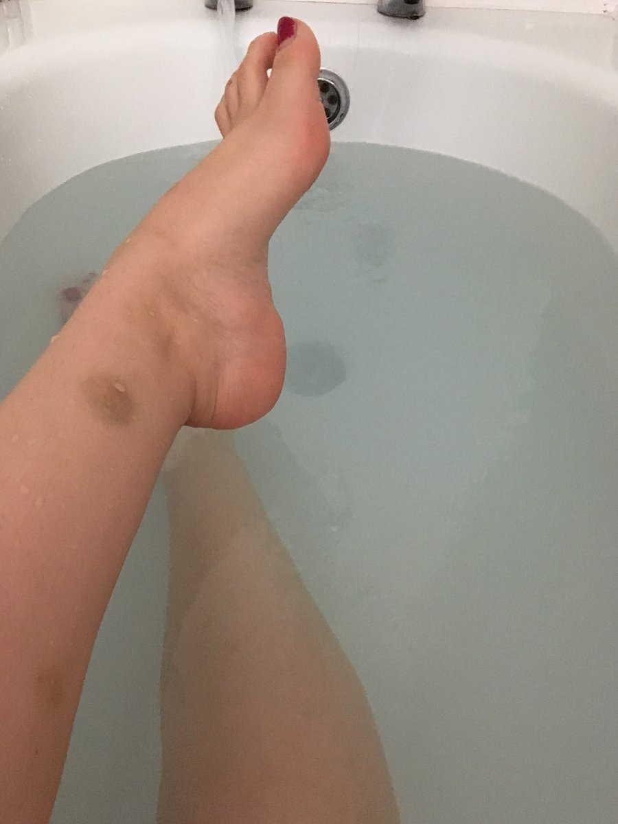 queenkittydom's tweet photo. Bruised from my walk today! Too many rocks @RTfeet @RTPET4  @RTfindomfeet https://t.co/FjRjkxGBE6