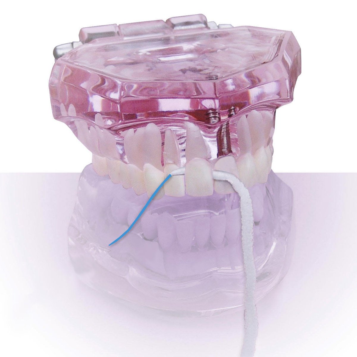 ProxySoftFloss's tweet photo. Do you suffer from #PeriodontalDisease? Try #ProxySoft Periodontal #dentalfloss, featuring a built-in ultra-stiff threader, floss &amp; an extra-thick brush section to clean large spaces between teeth caused by #gumrecession. Request a FREE sample: https://t.co/WJ9TXS1Fec https://t.co/R6oyoKEDvr