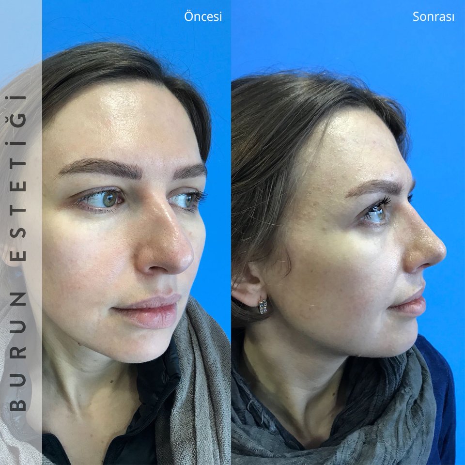 Prof Dr Koksal Yuca Yorum Oku Ve Randevu Al