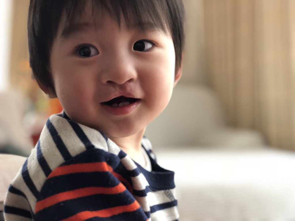 "弊息子，術後2ヶ月． https://t.co/PsEvncZSXd" - @ochyai, ドクター落合陽一's ... - 1024 x 768 jpeg 62kB