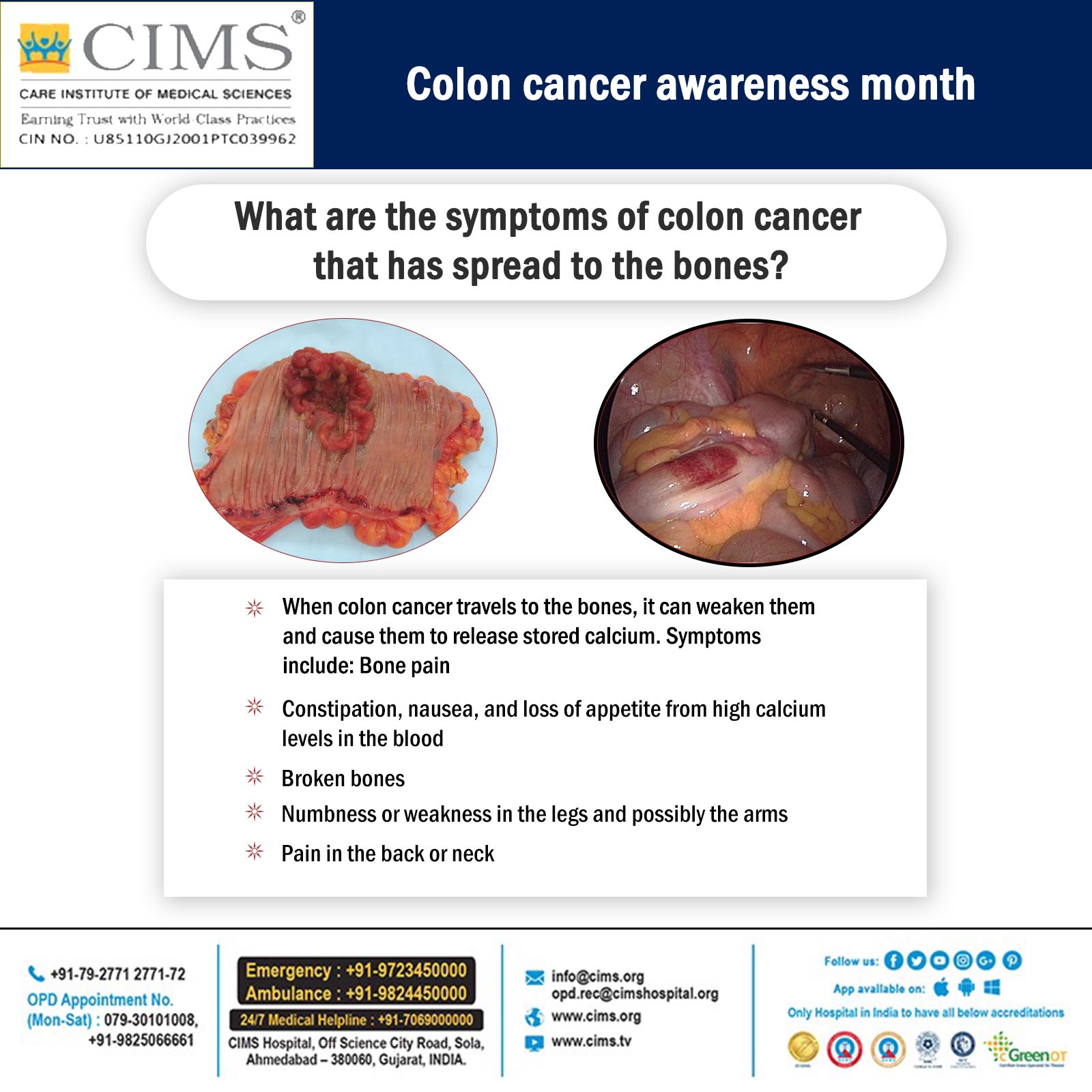 Cancer colorectal constipation, Colorectal cancer during pregnancy