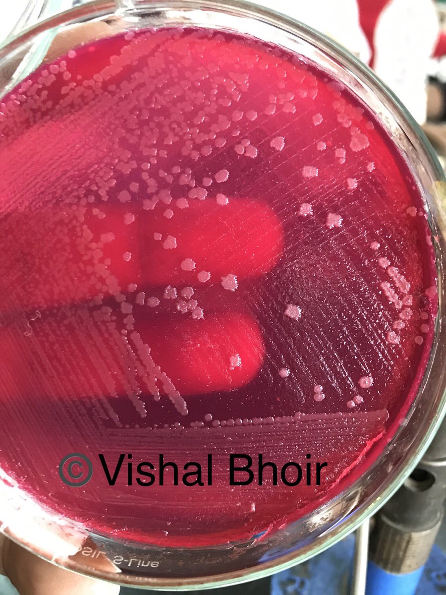 The_Bioway's tweet photo. Salmonella typhi Bacteria on MacConkey's Agar!
#macconkeysagar #Salmonella #medicalmicrobiology #microbiology https://t.co/ZELYCt7XeE