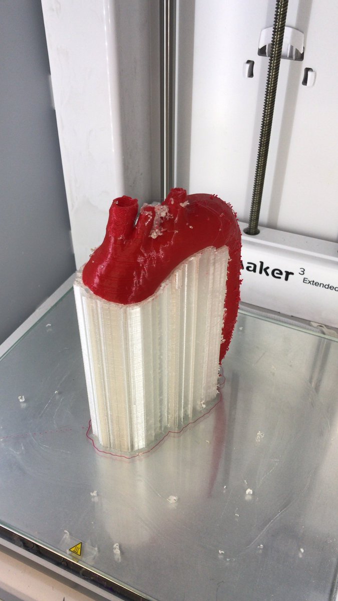 CharlieMonitor's tweet photo. Cost effective 3D flexible model of a healthy Aorta used as a reference guide during surgery printed at @3d_maranon. @rupermac @calvoharo_ja @3DGabBME @BiomedEstefania @BiomedAdrian https://t.co/Grnt2yAekB