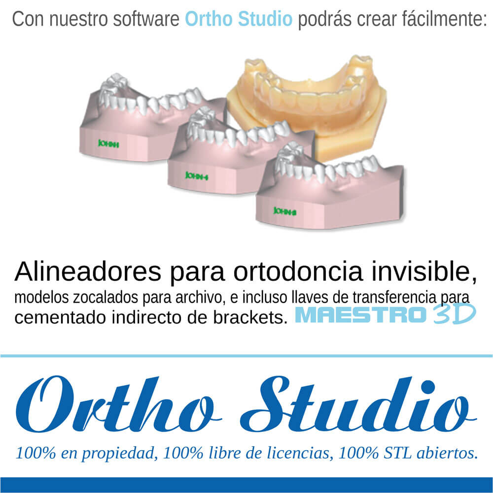 simple3Dent's tweet photo. #ED18 Nos encontrarás en el stand 3F24 @rayadental | @KeystoneInd. Entre lo que llevamos, están las novedades de nuestras soluciones CAD, como #OrthoStudio de @maestro_3d con todo su potencial. https://t.co/QcDRnyL1d7