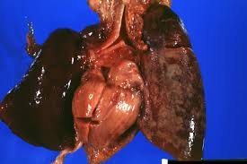 Edessal_Shouse's tweet photo. I learned that the different coloring of the lungs is based on how the body was positioned.  #rhsbms https://t.co/myf86sNaPN