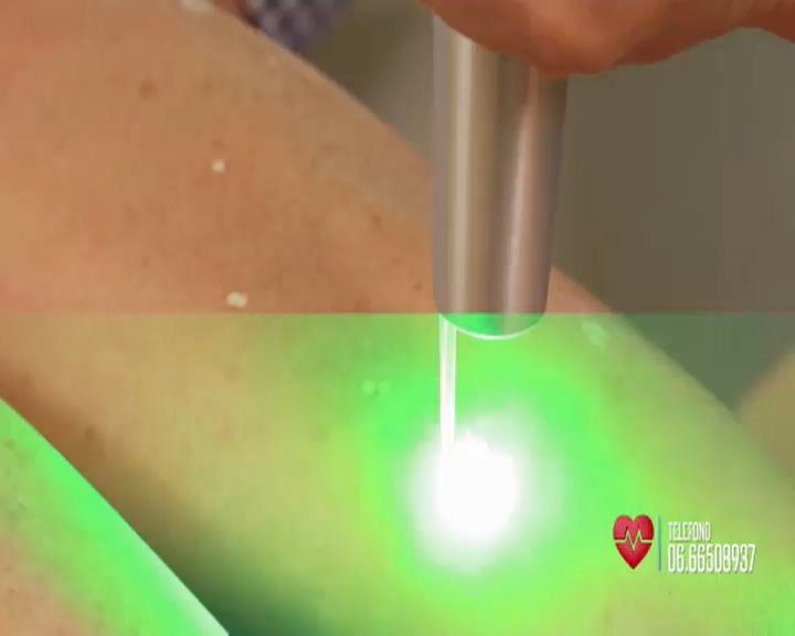 medicotv2000's tweet image. #Macchie della pelle addio! Adesso a #Buonaseradottore vi presentiamo un laser di ultima generazione in grado di cancellarle definitivamente in pochi secondi! Ora su @TV2000it canale28 @MommyDil @drivanoluppino