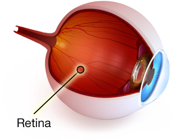 NatlHealthNews's tweet photo. "Treatment Options for Retinal Conditions" by @McLeodOptometry https://t.co/yiBJzNeFKK  #Retina #EyeCare #DiabeticRetinopathy https://t.co/BC3kcG1qGo