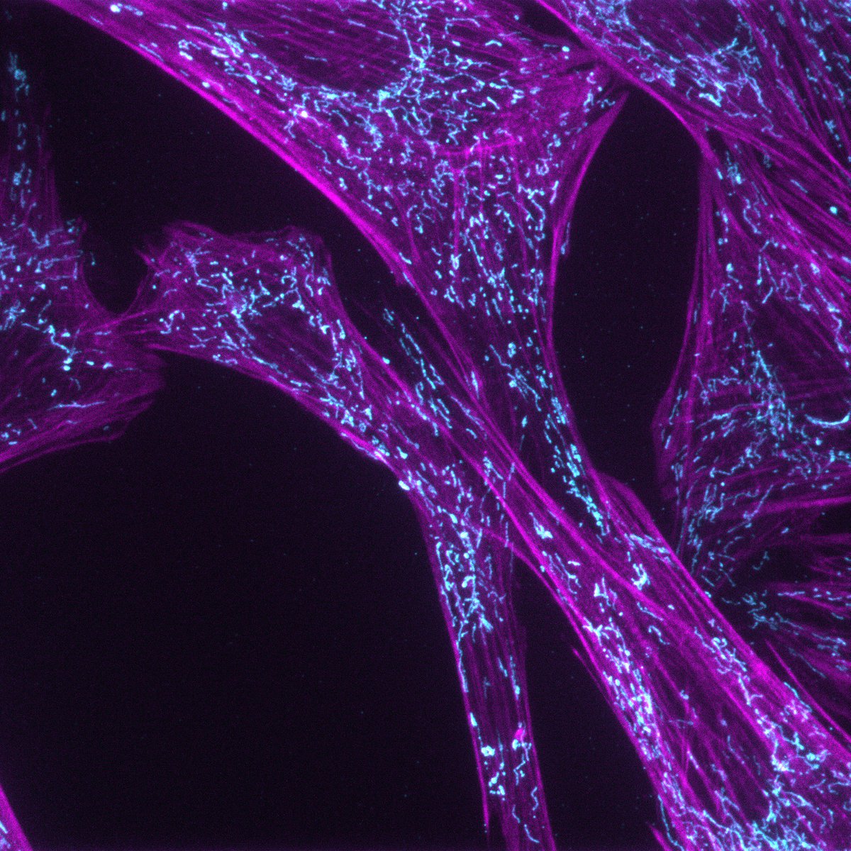 Photometrics's tweet image. Gorgeous labelled actin and mitochondria images coming out of California this week. The Prime BSI is really showing what it&apos;s made of